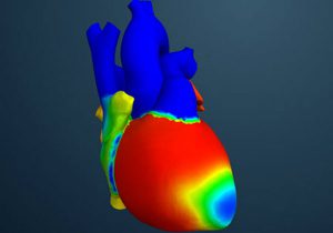הדמיה של לב במסגרת פרויקט "הלב האנושי". מקור: דאסו סיסטמס
